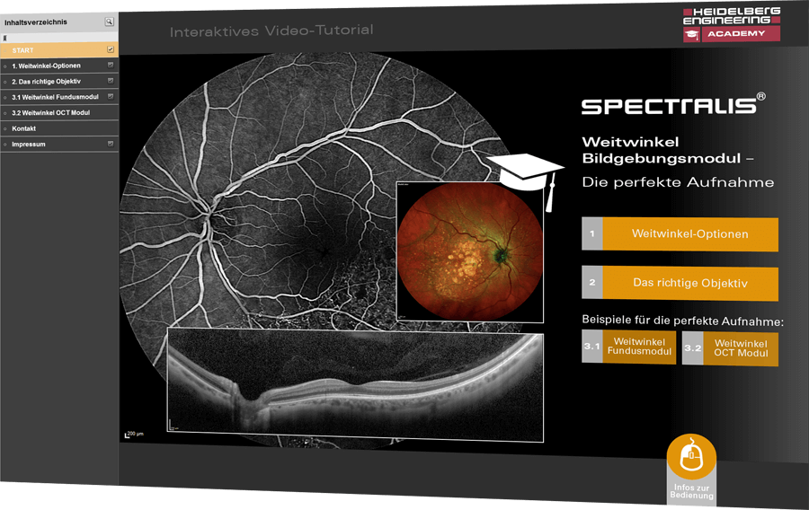 IVT Weitwinkel Bildgebungsmodul