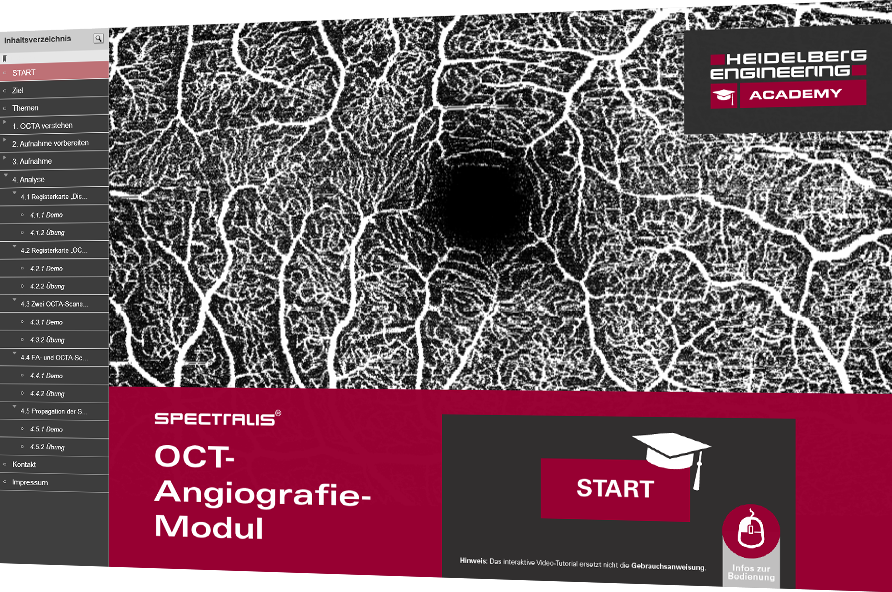 Iinteraktive Video-Tutorial OCT Angiografie Module