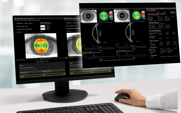 1. ANTERION Anwendertreffen