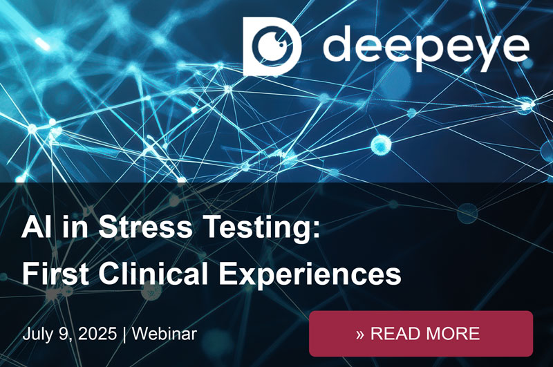 DeepEye Webinar